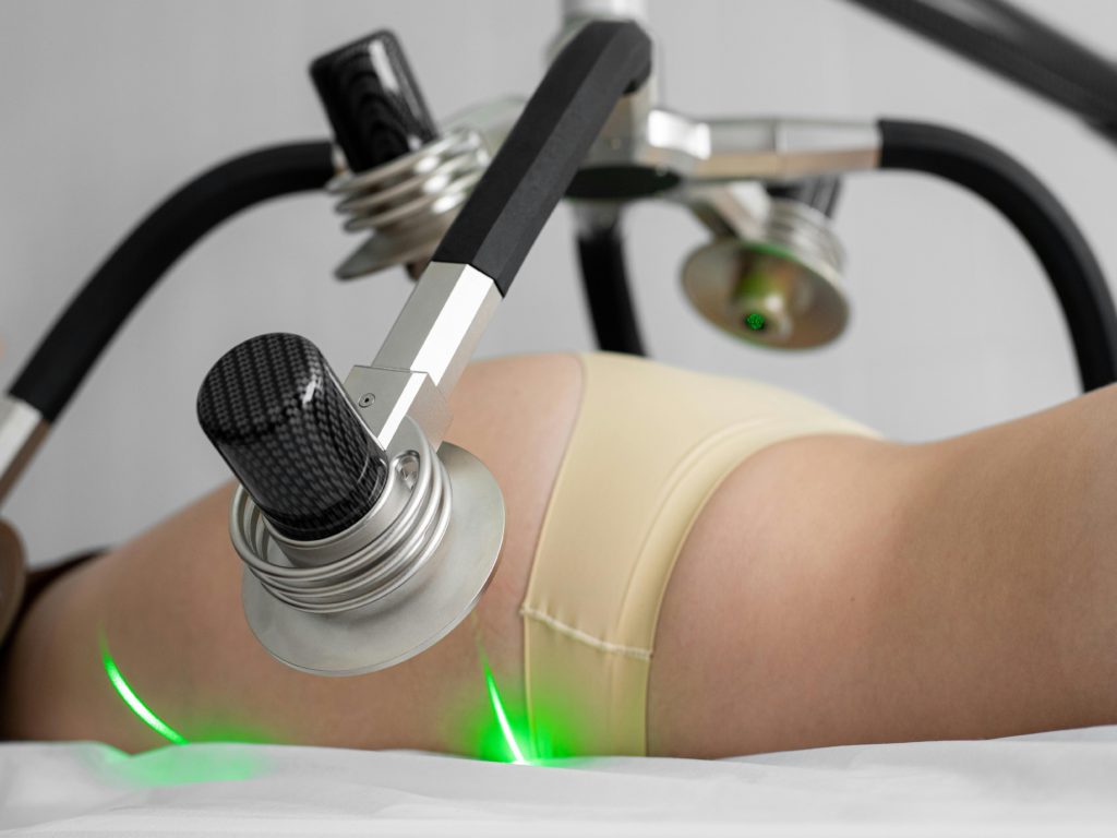 Co je to Liposonix a jak funguje HIFU technologie při hubnutí?